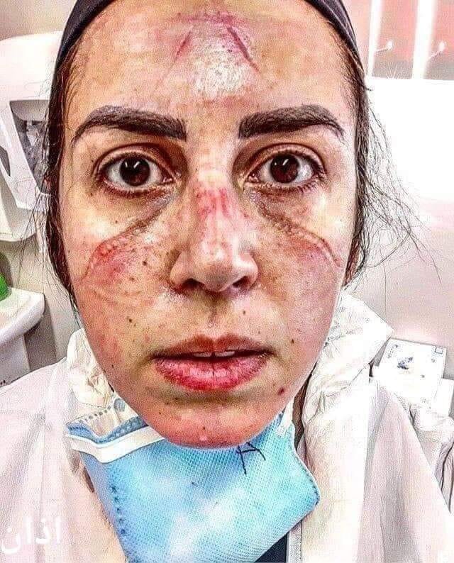 تم لوگ چائنہ کے ڈاکٹرز کو سلام پیش کرتے ہو دیکھو پاکستانی بہن جو فرنٹ لائن پر کرونا کا مقابلہ کر رہی ہے